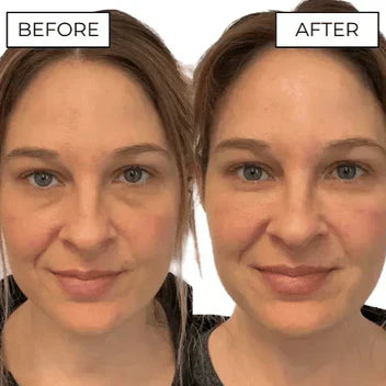 Eye Glasses Massager