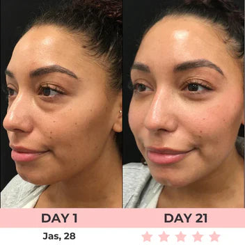 Eye Glasses Massager